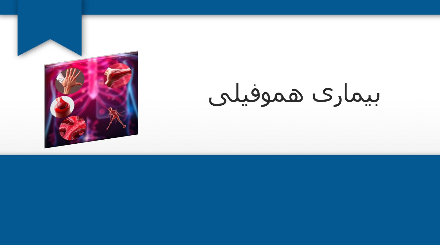پاورپوینت درباره بیماری هموفیلی